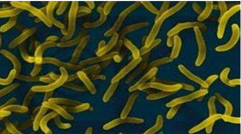 微生物菌劑好？好在哪里您知道嗎？